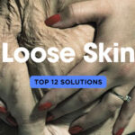 Top 12 Ways to Deal with Loose Tummy Skin